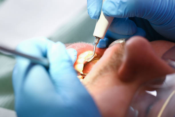 Best Emergency Dental Extractions in Sneads Ferry, NC