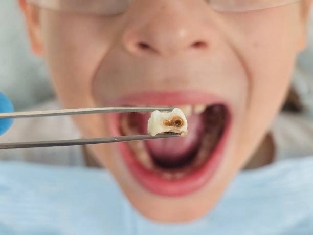 Best Emergency Dentist for Knocked-Out Tooth in Sneads Ferry, NC